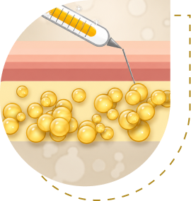 How it works image 1