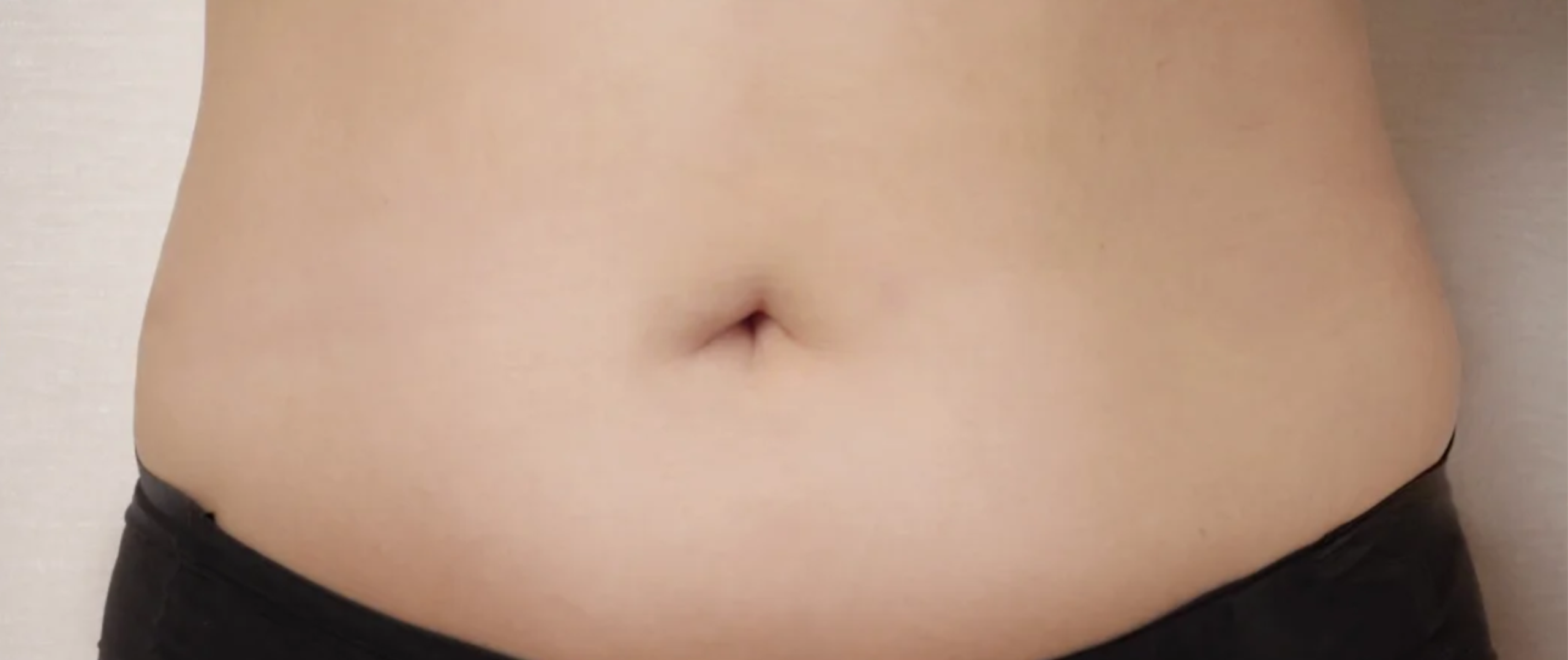 Before procedure image