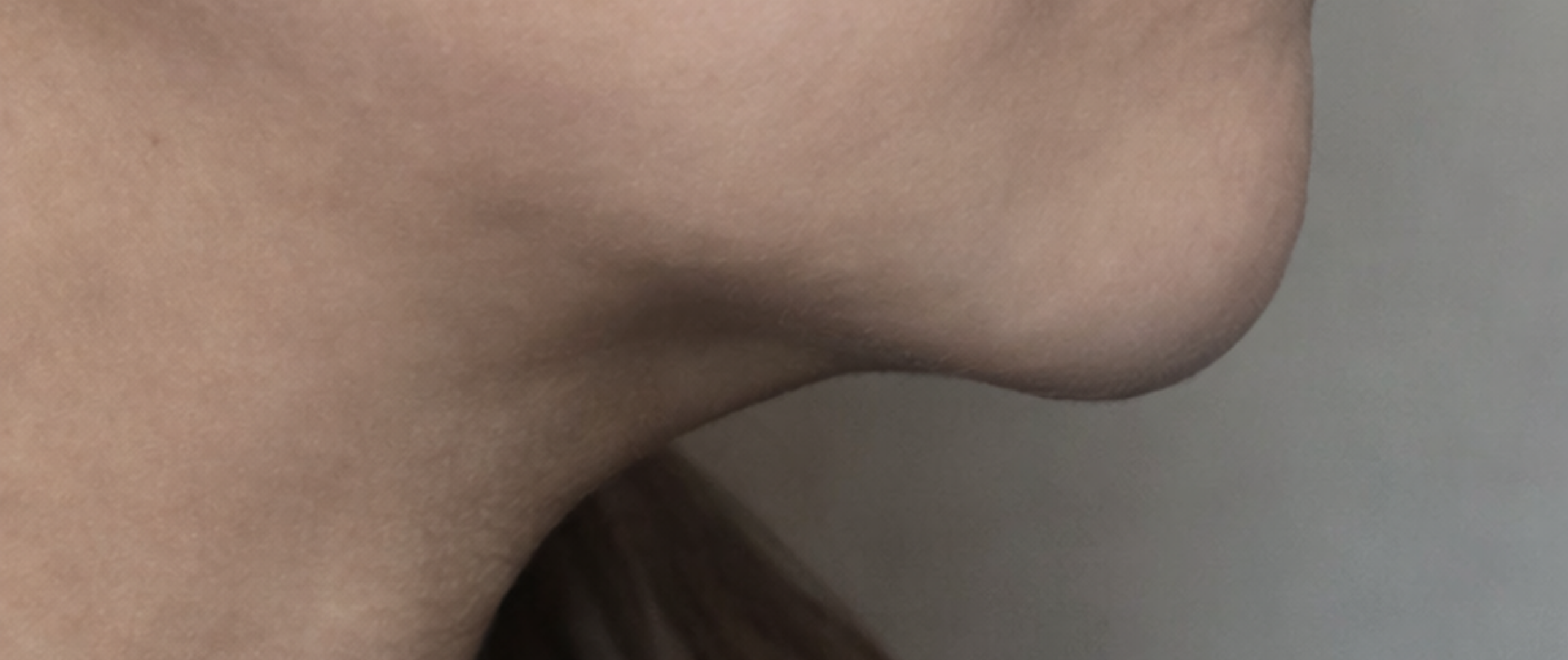 Before procedure image